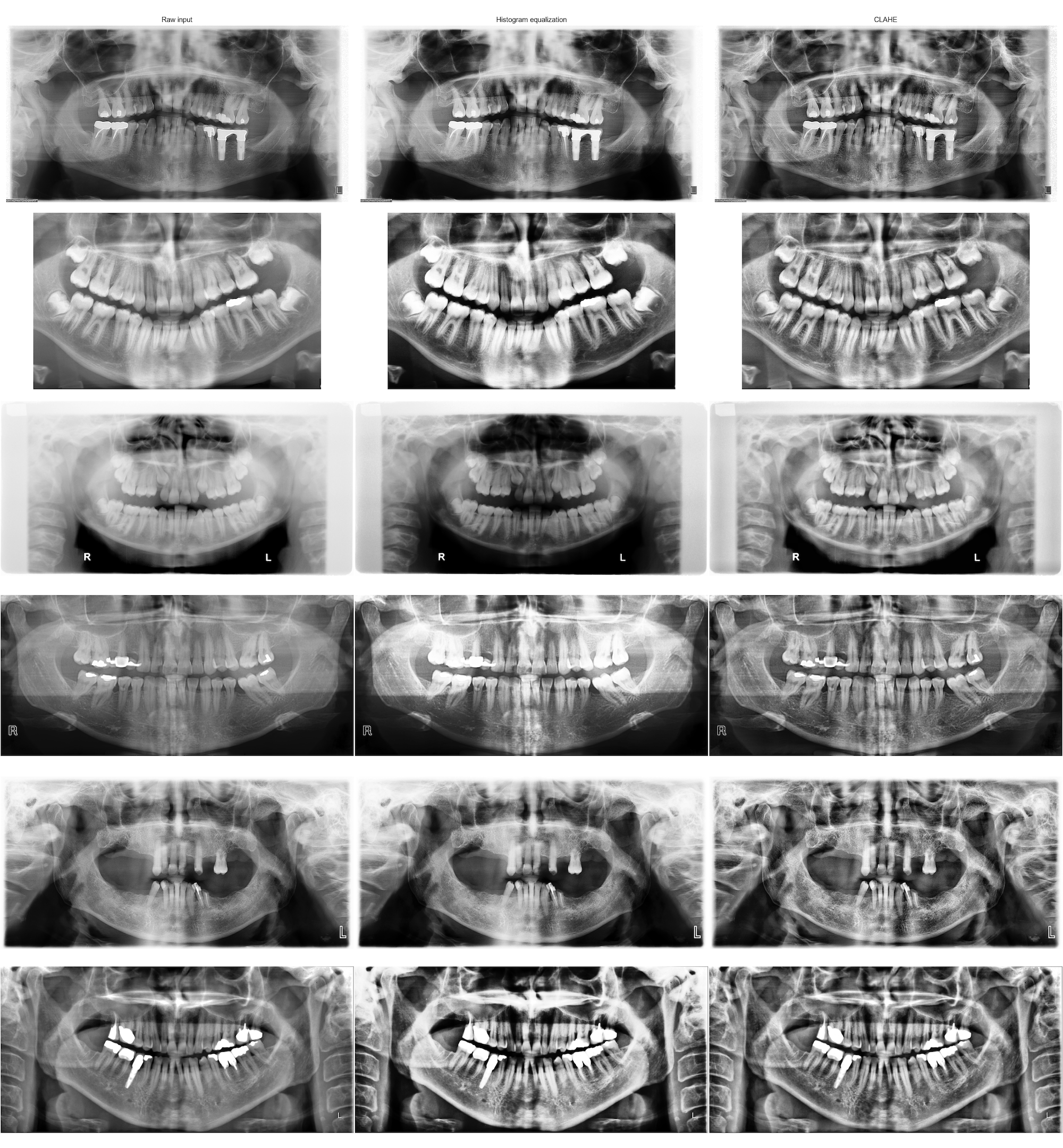 assets/images/dental/dental-2-clahe.png