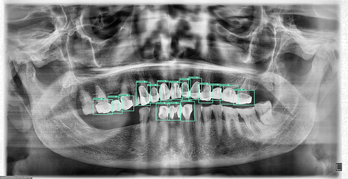 assets/images/dental/dental-2-example1.png