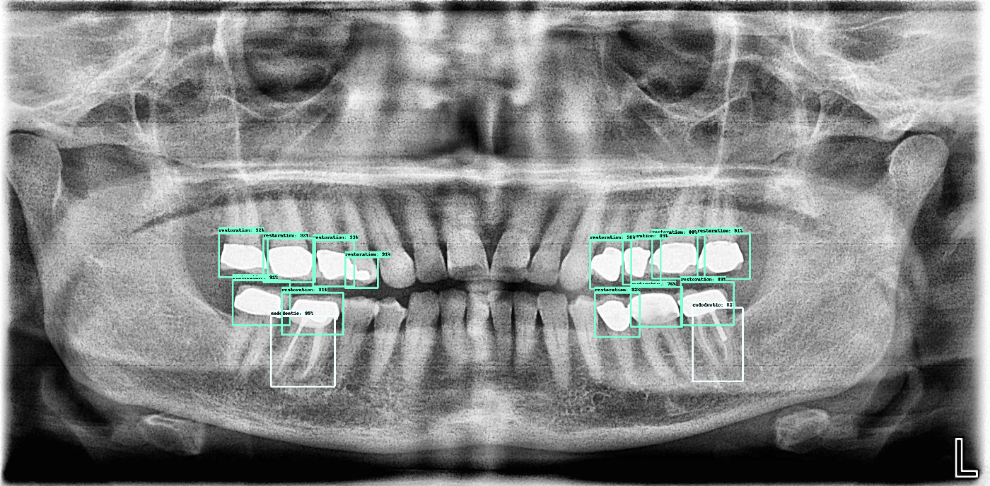 assets/images/dental/dental-2-example2.png