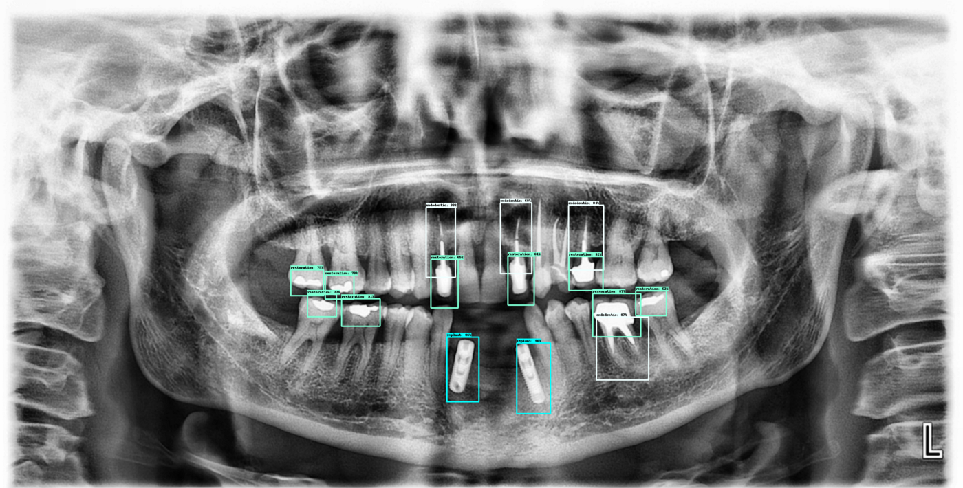 assets/images/dental/dental-2-example3.png