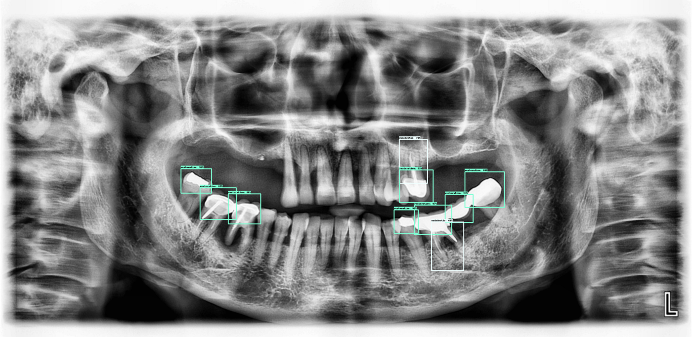 assets/images/dental/dental-2-example4.png