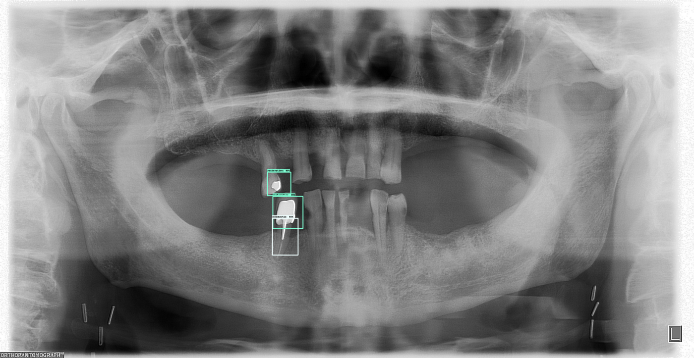 assets/images/dental/dental-example1.png