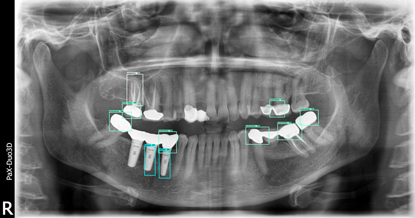 assets/images/dental/dental-example3.png